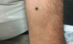 Kayseri’nin bir ilçesinde daha kene vakası