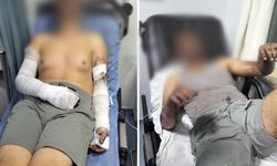 Manisa’da sanayi sitesinde patlama: 2 yaralı