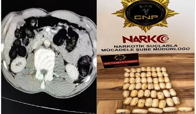 Yabancı uyruklu şahsın midesinden 53 paket uyuşturucu çıktı