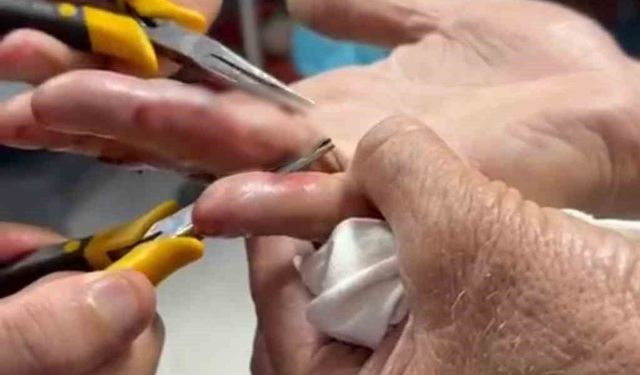 Batman yaşlı adamın parmağına sıkışan yüzük hastanede çıkarıldı