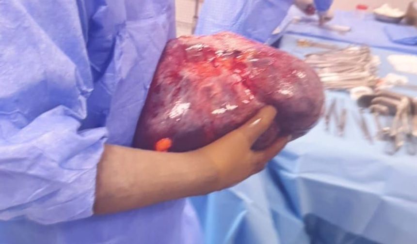 14 kiloluk tümör ameliyatı sonrası dikkat çeken iyileşme hikâyesi